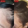 Suplemento Xic Glam Folix Anticada Y Crecimiento De Cabello