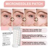 Microdart Pimple Patch - Acne Patches - Spot Patches with