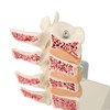 Osteoporosis Spine Model for Teaching and Demonstration, Visualize Bone Density