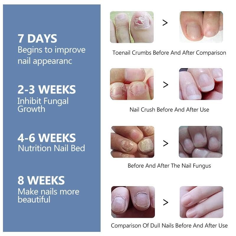 Vamy Vamy Nail Care Moisturizer.Nail Health Care Solution with Lavender