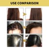 100ml Ginger Hair Regrowth Shampoo Dandruff Removal Itching Relief Deep