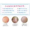 メディユース パールホワイト スキンソープ 4個セット ネット付き
