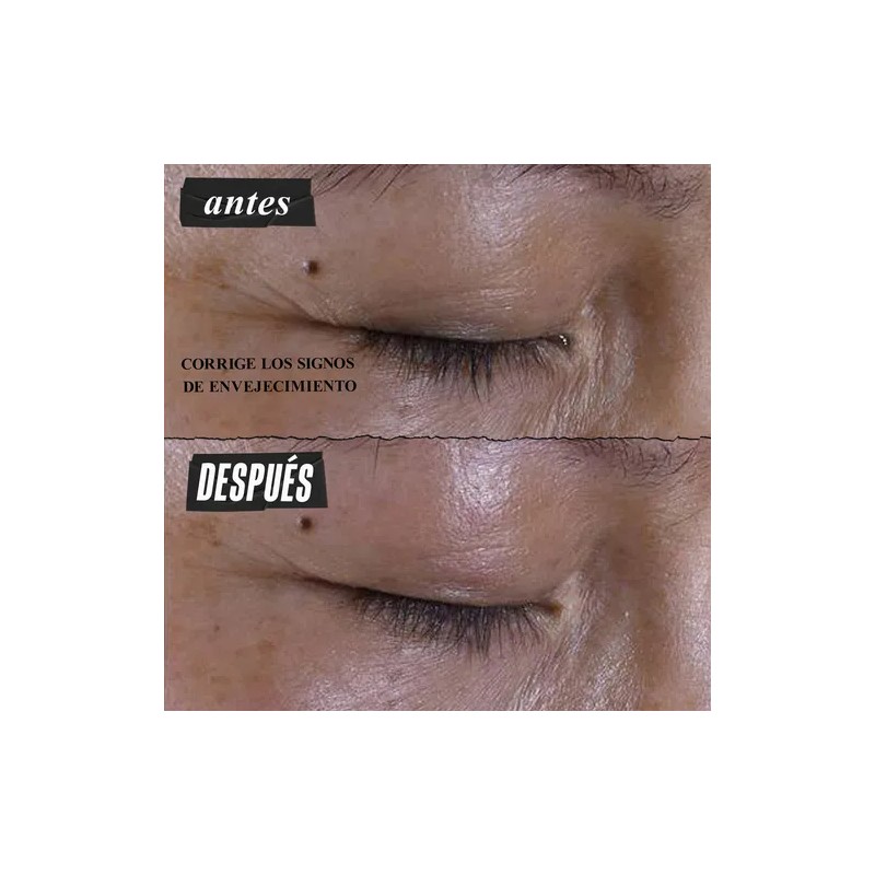 Crema Kiehl's Super Multi-Corrective para Contorno de Ojos, con Péptido