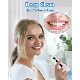 Monstyle Irrigador Bucal Portatil, Water Flosser,Limpiador De Dientes A Presion De Agua,Irrigador Dental Con 5 Boquillas 3 Modos 300ml, Usb Recargable Ipx7 Impermeable Irrigadores Bucales, De Familia Y Viajar