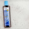 Neutrogena 3 NEW Equate Dandruff Compared to Neutrogena T/Gel Therapeutic