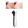Vacuum Black Head Remover Household Rechargeable Face Pore Vacuum Cleaner