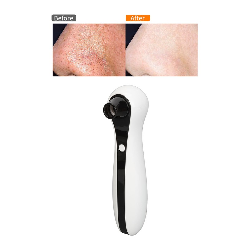 Vacuum Black Head Remover Household Rechargeable Face Pore Vacuum Cleaner
