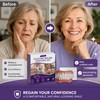 Temporary Cosmetic Denture Set for Adults – Soft Upper &