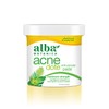 Alba Botanica AcneDote Anti-Pimple Pads, 60 Count (Packaging May Vary)