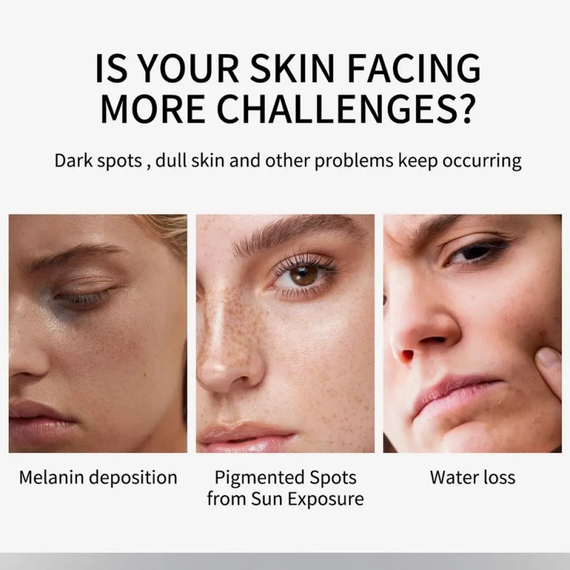 Útil Crema Reparadora De Manchas Oscuras, Crema Facial Corre