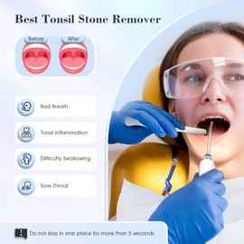 Tonsil Stone Remover Kit,3 Modes Electronic Tonsil Stone Remover Vacuum,Oral Irrigator for Best Tonsil Stone Remover LED Light,Tonsil Stone Mouthwash 5X Magnifying Mirror,Fight Bad Breath Tonsil Stone