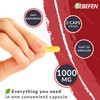 Mastic Gum 1000 mg Supplement - Dietary Supplement for Supports