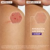 Aderma Epitheliale Ultra Repair Crema Antimarcas