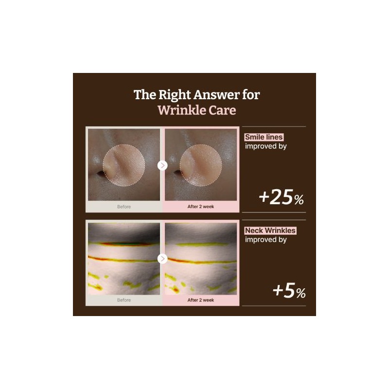 Dr.Reju-All [Dr.Reju-All]Advanced PDRN Rejenating Mask (4ea)