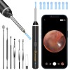 VITCOCO HD Ear Scope with Camera - 1920P WiFi Otoscope