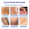 Cicatrizes Gel Reparador De Cicatrizes Fade Scars