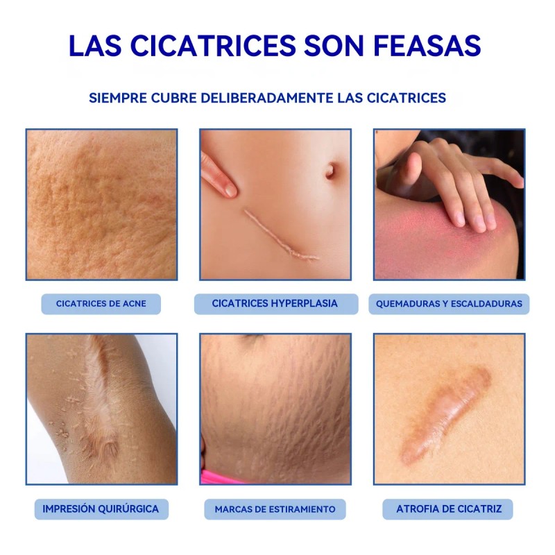 Cicatrizes Gel Reparador De Cicatrizes Fade Scars