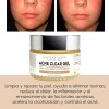 Gel Facial Anti-acné Graso Con Impurezas