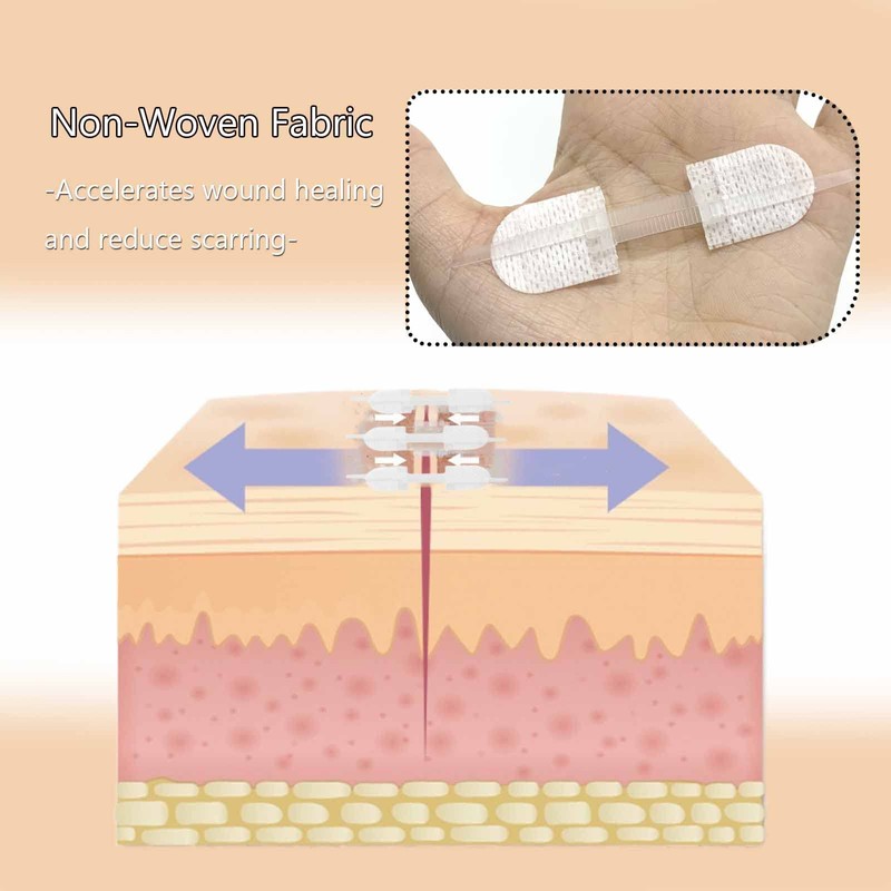 Emergency Wound Care Closures Band Aid, Zip Repair Without Stitches