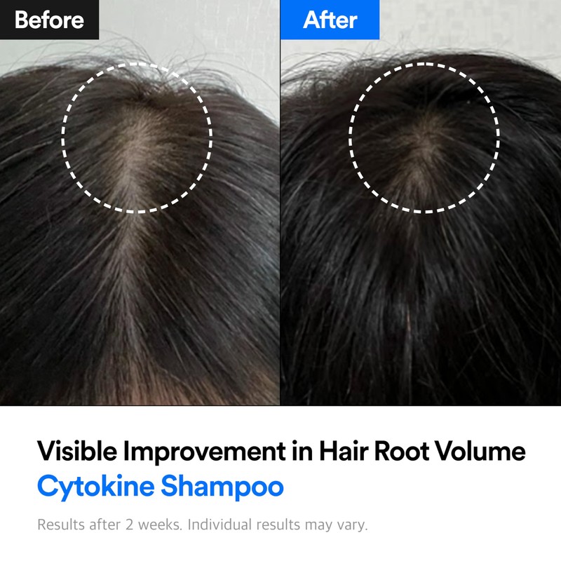 Hair-Recovery Cytokine Shampoo Plus Sensitive Care, 12.8 Fl. Oz. –