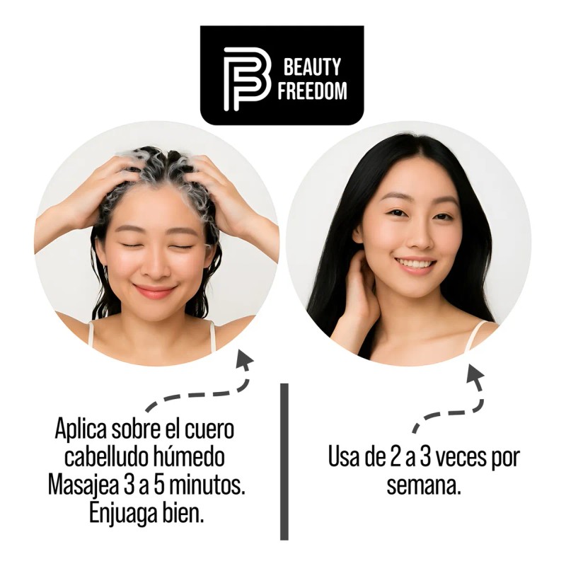 Shampoo Alquitran Essence Beauty Freedom 480ml Anticaspa