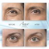 Puffy Eye GEL Instant results – Naturally rapid reduction eye