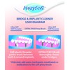 Thornton Super Floss Bridge Implant Type, 30 Pieces x 12