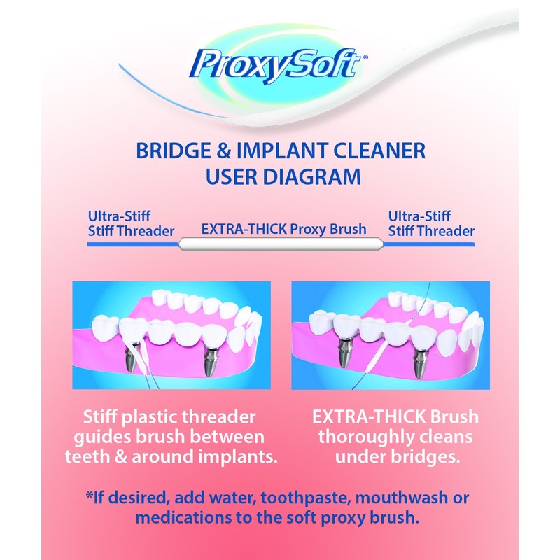 Thornton Super Floss Bridge Implant Type, 30 Pieces x 12