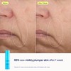 Skinfix Barrier+ Better Skin Starts Here Kit - Includes Mini