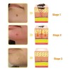 Crema Antipigmentaria Para Eliminar Las Verrugas Del Herpes,