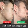 2pzs Bálsamo Ultra Potente Para Crecimiento De Barba