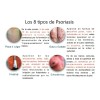 Crema Más Suave, Pepepsor Y Shampoo Para Psoriasis