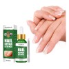 Líquido Reparador De Esmalte Líquido U Nail Repair Líquido N