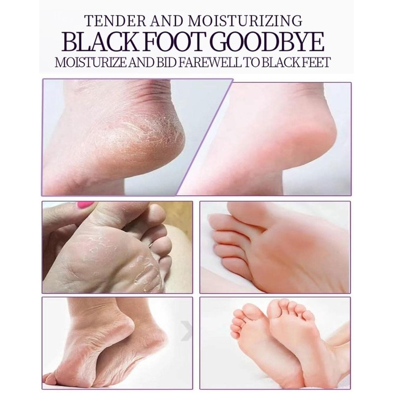 ZEXIJOW 3 Paar Fußpeeling-Masken,Feuchtigkeitsspendende Fußpflegemaske,Repariert Fersen,Entfernt abgestorbene und trockene Haut,Peeling-Fußmaske