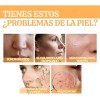 Ácido Glicólico Solución Tonificante Exfoliante Antimanchas