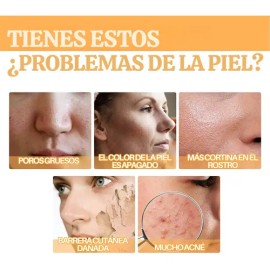 Ácido Glicólico Solución Tonificante Exfoliante Antimanchas