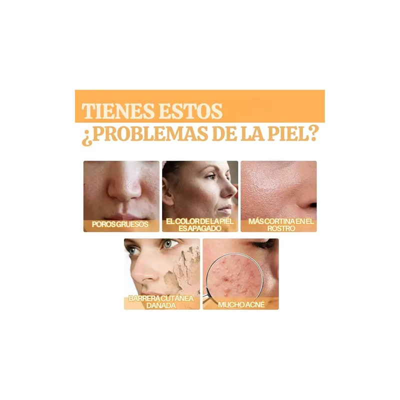 Ácido Glicólico Solución Tonificante Exfoliante Antimanchas
