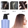 WINIFAN Anti Dandruff Anti Itching Oil Control No Silicone Oil