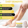 Premium 40% Urea Cream For Feet - Made In USA