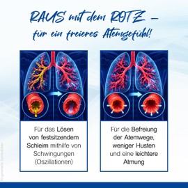 CEGLA RC Cornet PLUS OPEP Respiratory Therapy Device to Support Mucus Solution - 2 Coordinated Settings - Can be Combined with Inhaler - Medical Device from Germany