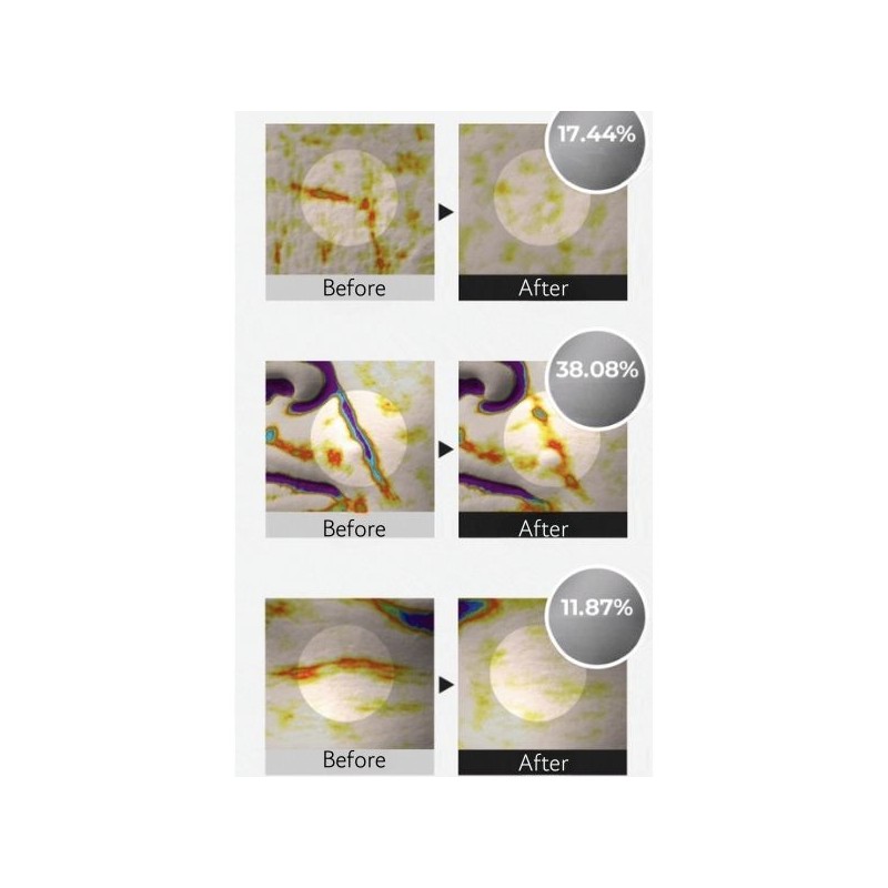 SKIN & LAB Retinol Lifting Roller Cream 50ml