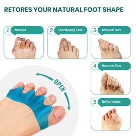 Welnove 8 Pack Toe Separators, Bunion Corrector for Women/Men, Toe Spacers, Foot Alignment - Dividers to Correct Bunions, Hammertoes, Relief Restore Feet (Blue)