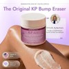 DUMA Doctor 각질층, 건조, 거칠고 울퉁불퉁한 피부를 위한 10% AHA