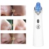 Pore Vacuum Blackhead Remover USB Rechargeable Strong Suction Electric Comedone