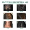 Suero Crecimiento Del Cabello Boomoon Aceite De Jengibre