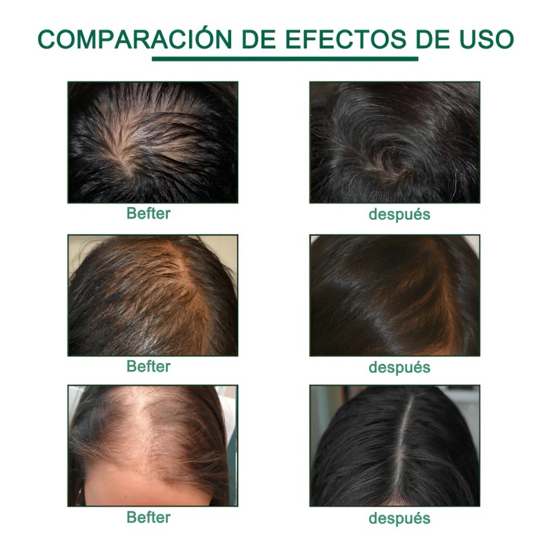 Suero Crecimiento Del Cabello Boomoon Aceite De Jengibre