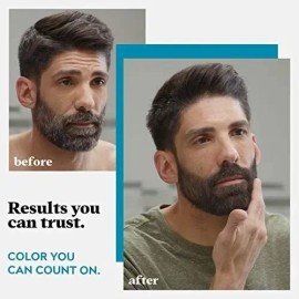 Aceite Para Barba Y Bigote 30ml Nutrición Crecimiento Brillo