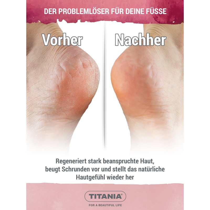 TITANIA Cracked Ointment for Cracked & Dry Feet - First