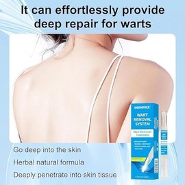 Wart Removal Pen for Warts, Corns, Spots, wart Removal Pen for face, Body and Hands Skin tag Removal kit-4ml