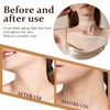 Pacify 6 Pack Silicone Chest Wrinkle Pad & Neck Patches